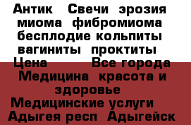 Антик.  Свечи (эрозия, миома, фибромиома, бесплодие,кольпиты, вагиниты, проктиты › Цена ­ 550 - Все города Медицина, красота и здоровье » Медицинские услуги   . Адыгея респ.,Адыгейск г.